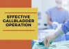 Get Rid of Gallbladder Stones by Undergoing an Effective Gallbladder Operation in UAE
