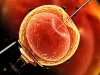 Average Number of Eggs Retrieved for IVF Process - BSI Clinics
