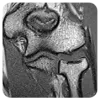  Elbow Treatment in Mumbai - Dr. Pranjal Kodkani 