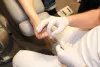 Importancia de eliminar uñas enterradas del pie diabético – entreamigos.com.es