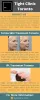 Forma Skin Treatment Toronto Ti - tightclinic | ello