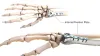 Employment of Braces After Internal Fixation | Health2med