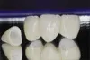Devs Oral- Cosmetic dentistry in Pune