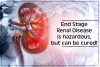 End Stage Renal Disease is Hazardous, But Can be Cured!