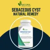 Sebaceous Cyst Removal Techniques