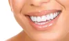 Advanced Laser Dentistry