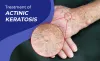 Everything You Want to Know about Successfully Treating Actinic Keratosis
