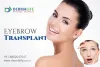 Eyebrow Transplant: Procedure, Cost, And Side Effects	