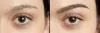 Eyebrow Hair Transplantation in Tirupati - Dr.Sajjas.in