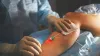 Signs You Need To See A Vein Doctor Now! | veintreatmentmanhattan