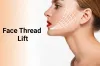 Best Thread Lift Treatment In Gurgaon
