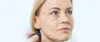  Best Face Lift Surgeon in Malviyanagar, South Delhi - Dr. Hiranmayi Jha
