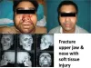 Best Facial Injury Treatment in Delhi - Plastic Surgeon in Delhi