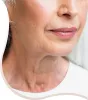 Facial Volume Loss - Enrichment Skin Solutions