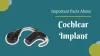 Important Facts to Learn About Cochlear Implant Surgery | Adventis