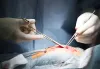 Untitled — An overview of the medical device market in France