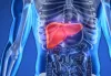 All About Liver Transplant, Cost, Common Reasons in India