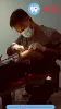 Full Denture Implants in California