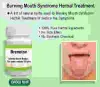 Natural Remedies for Burning Mouth Syndrome Help to Relieve the Pain