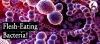 flesh-eating bacteria