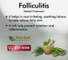 Herbal Treatment for Folliculitis inflammation of hair follicles in its simplest form appears as a small bump on part of skin which has hair follicles. The treatment of which is based on simple management, with readily available Natural Remedies for Folliculitis. Luckily, there are several effective, affordable, and easy natural remedies for folliculitis to get rid of the discomfort and disruption of normal hair growth caused by scalp folliculitis.