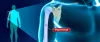 Management of the Closed Fracture of the Humerus - Siiora.org