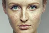 Clear and Brilliant Laser Treatment | Anti-Aging Treatment | Lucere