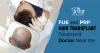 Hair Transplant Treatment Doctor Near me by AKSClinic