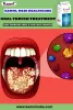 Fungal Infection Oral Medication | Kamol Medi Healthcare