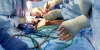 Gallbladder Stone removal surgery through laparoscopy