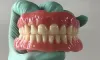 Dentures Repairs Penrith | Dentures Repair in Blue Mountains | Katoomba