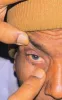 Best Eye Charity in UK, Sight Loss Charity London | Mission 4 Vision