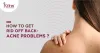 Say Goodbye to Back Acne Scars: Effective Strategies for Treatment - Skin Solutionz