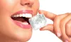 Keeping Good Oral Health Prevents Dental Sensitivity