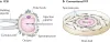 In Vitro Fertilization/Intracytoplasmic Sperm Injection for Male Infertility.