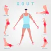 Ayurvedic Treatment For Gout Problem | Kidney And Ayurveda