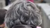 Grey Hair Causes At Young Age