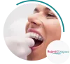 Teeth Braces, Invisible Braces, Clear Braces by Rejové32 Aligners