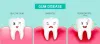 The Causes, Signs, Prevention, and Remedy Options for Gum Disease