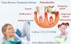 Gum Disease Treatment Auburn | Dental implants Near Me WA