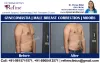 Gynecomastia in Ludhiana ,Chandigarh And Punjab