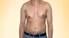 Best Gynecomastia Surgeon in Dubai - Anshu Mishra