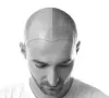 Best Plastic and Cosmetic Surgeons in Delhi | The Aesculpir