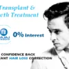 Hair Transplant Treatment | Hair Transplant Doctor and Specialist