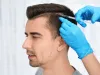Hair Club Pakistan