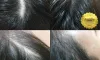 Hair Tattoo Treatment