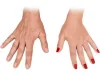 Hand Rejuvenation with PRP treatment in Dubai