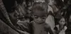 Child Health And Nutrition In India 