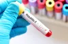 Sovihep V Tablets to Treat HCV
