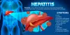 hepatitis_guide.jpg